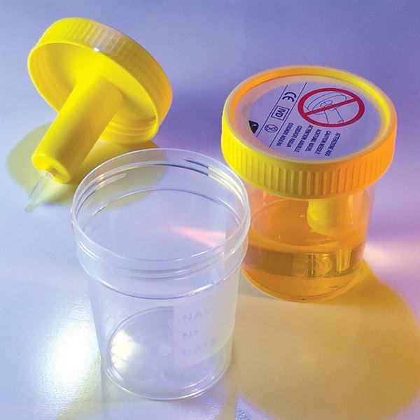 Urinalysis