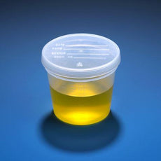 Specimen Container, 5oz. with Separate Snap Cap, PP, Graduated-5917